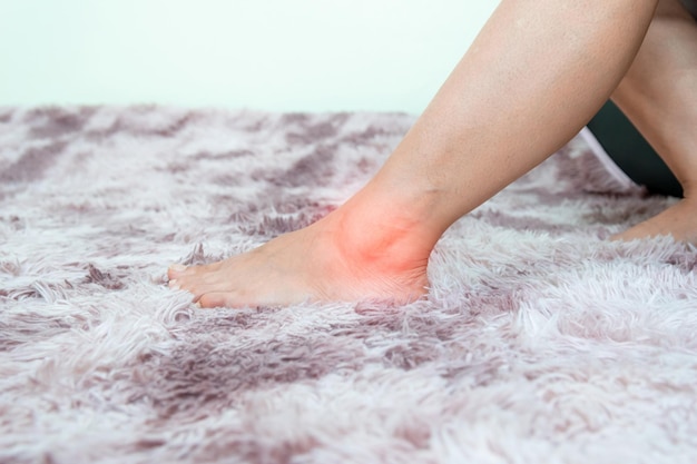 사진 인간의 발 의 발목 염증