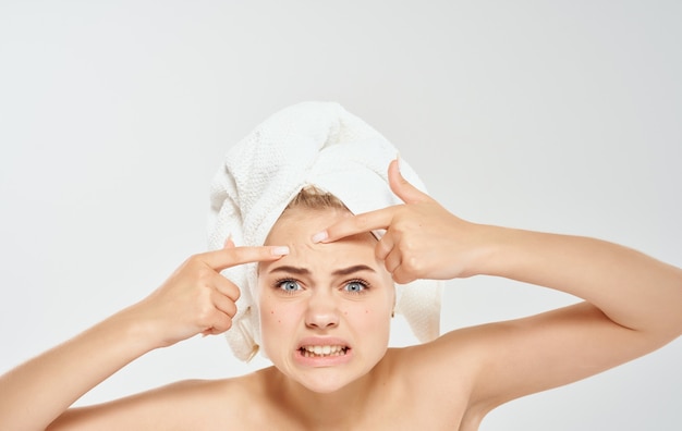 Annoyed woman squeezes out pimples on her face and a towel on
her head