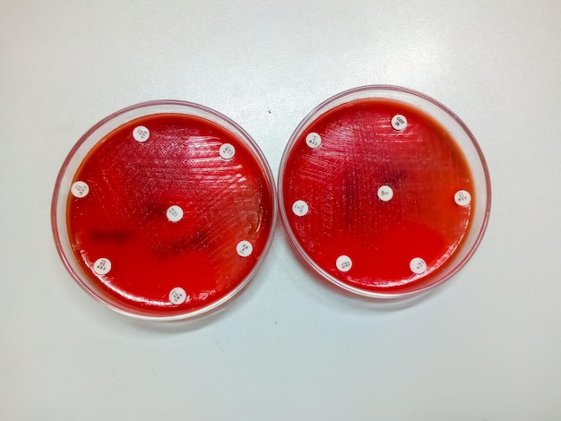 Antibiotic resistance test of bacteria