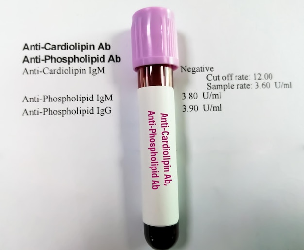 AntiCardiolipin Ab and AntiPhospholipid Ab test autoimmune disorder diagnosis