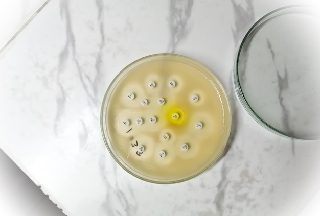 Antimicrobial susceptibility testing in petri dish. Antibiotic resistance of bacteria.