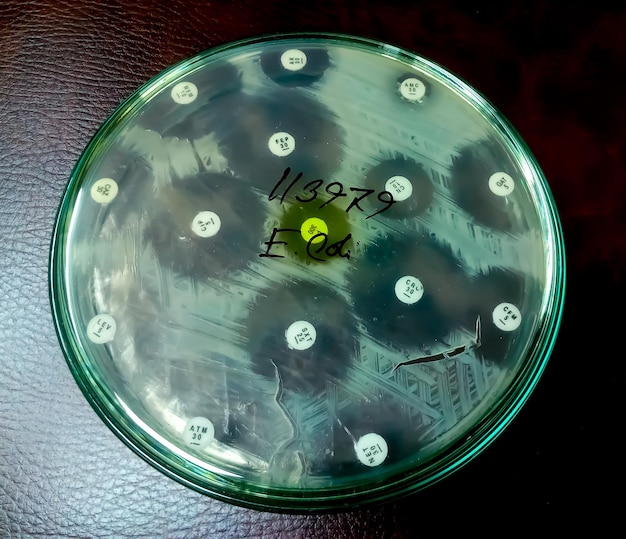 ペトリ皿での抗菌薬感受性試験