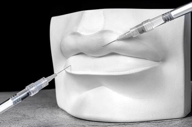 医療用注射器でアンティーク石膏唇 リップ増強の概念