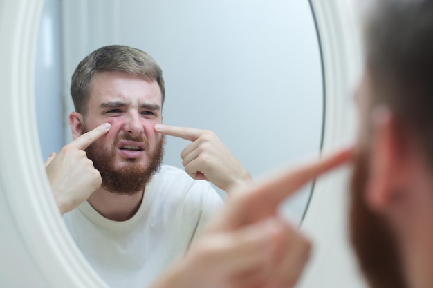 Photo anxious young man look in the mirror worried about wrinkle or acne on unhealthy skin upset unhappy