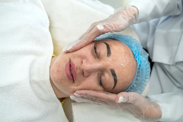 ビューティー サロンでのレーザー治療の前に、若い女性の顔にハイドロゲル マスクを適用します。