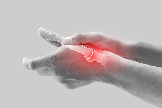 Arthritis of the finger and thumb joint