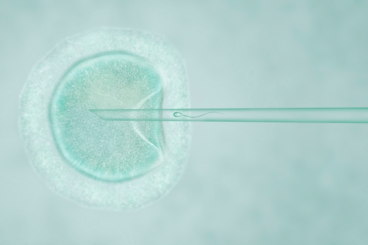 Photo artificial insemination by intracytoplasmic sperm injection