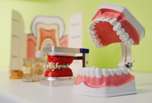 Artificial jaw on the table in the dentist's office close-up