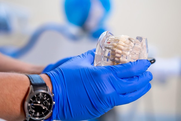 Foto mascella artificiale in plastica con impianti dentali per l'allenamento nelle mani del medico sfondo della clinica moderna messa a fuoco selettiva foto del raccolto primo piano