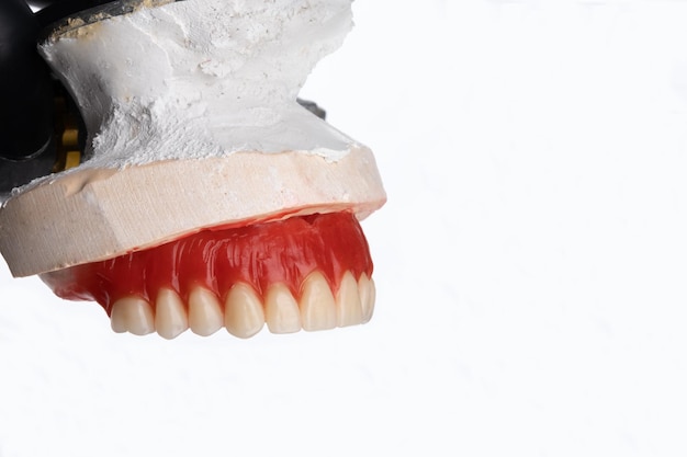 Artificial teeth arrangement of upper completed denture in articulator