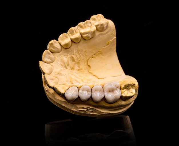 Photo artificial teeth