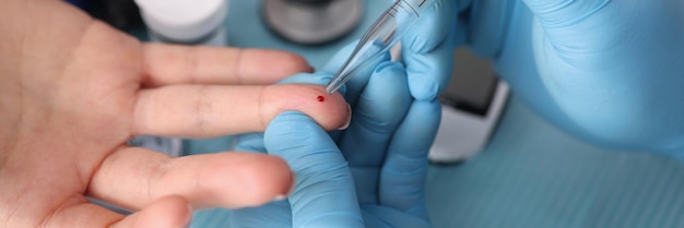 Arts die bloedonderzoek van geduldige vinger met pipet in laboratoriumclose-up neemt