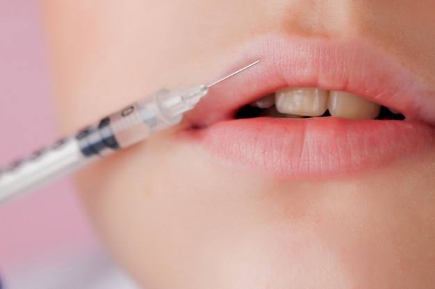 Arts in handschoenen die vrouwen botox injecties in lippen, op roze achtergrond geven