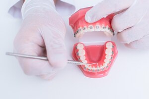 Arts-orthodontist laat zien hoe het systeem van beugels op tanden is gerangschikt