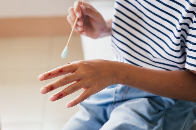 Photo asian child girl cleaning her wound on her finger injury and perform first aid by herself after she has been an accident.