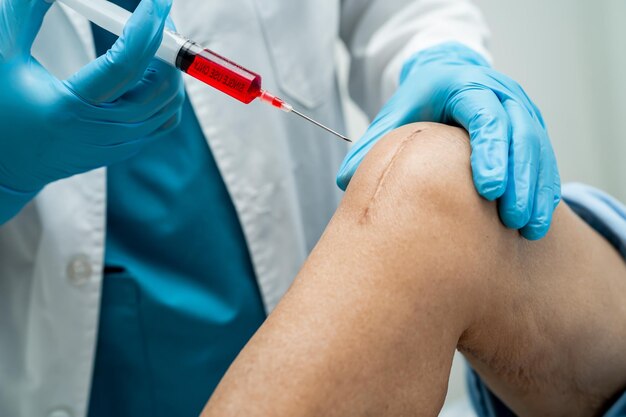 Азиатский врач вводит гиалуроновую кислоту, богатую тромбоцитами, в колено.