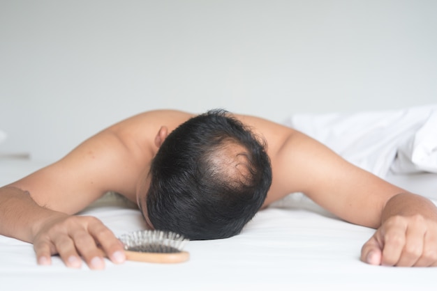 Asian man   are worried   with hair loss problem on the bed at home.