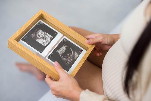 Asian pregnant woman hold with ultrasound photo at home