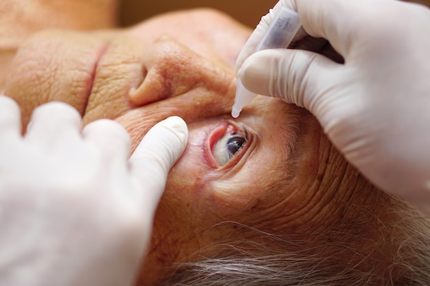 Asian senior or elderly old lady woman dripping medical drops in her eye by doctor