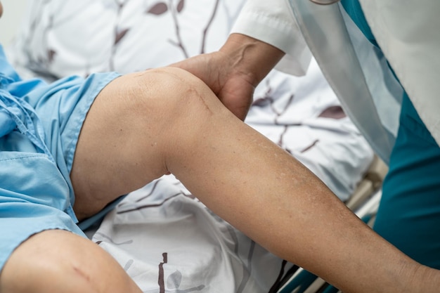 아시아 노인 또는 노인 여성 환자는 요양 병원 병동의 침대에서 흉터 수술 총 무릎 관절 교체 봉합 상처 수술 인공 관절을 보여 건강하고 강한 의료 개념