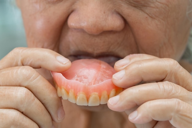 Asian senior or elderly old woman patient holding to use denture in nursing hospital ward healthy strong medical concept