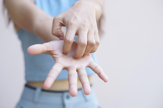 Photo asian woman having itchy skin on hand