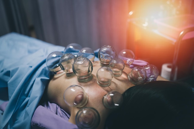 여성 환자의 등에 아시아 여성 물리치료사 침술이 침대에 누워 있다