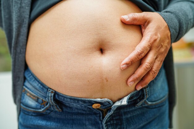 Premium Photo  Saggy belly folds of leather and fat on the sides hanging  over the waist of the jeans a figure spoiled by overeating or pregnancy  obesity and diabetes black background