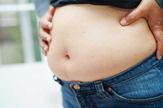 Asian woman show fat belly big size overweight and obesity at office