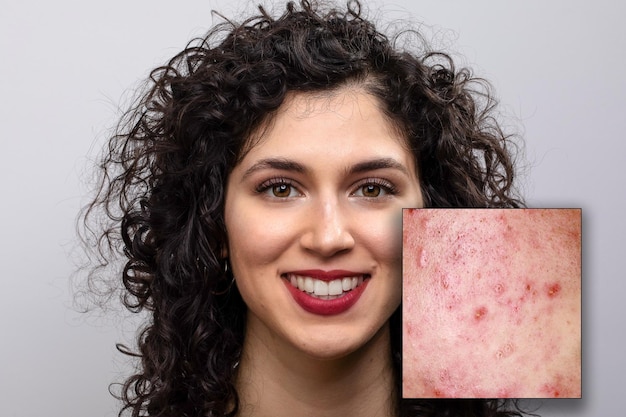 Привлекательная улыбающаяся брюнетка с ярко выраженными красными губами Молодая кудрявая женщина смотрит в камеру Увеличенная макродеталь дефектов кожи на щеке Концепция здравоохранения xDxA
