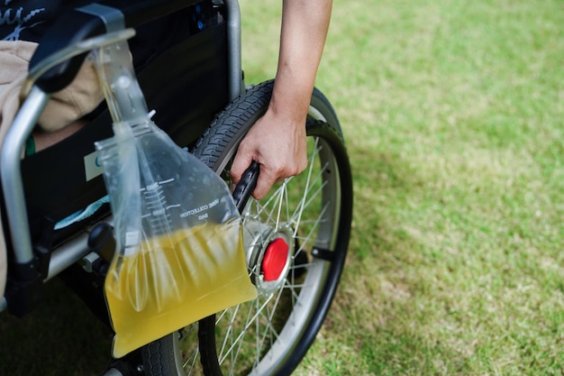 Aziatische handicapvrouw met urinezak op rolstoel