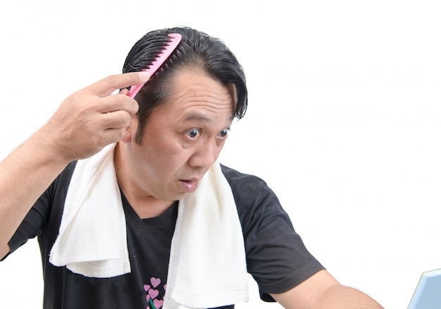 Aziatische mensenzorg over zijn geïsoleerd haarverlies of alopecia