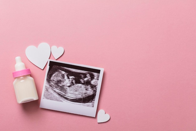 赤ちゃんスキャン超音波画像妊娠中の親の概念