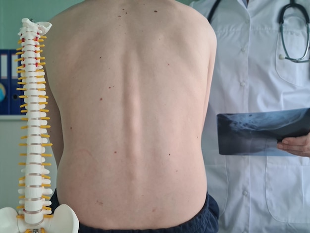 Photo back of a teenager with a spine clinic