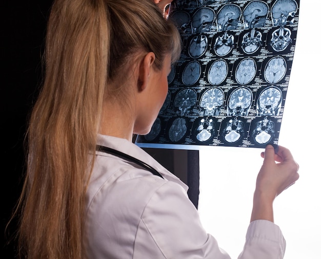 Back view of a doctor woman looking through mri of a human brain computed tomography