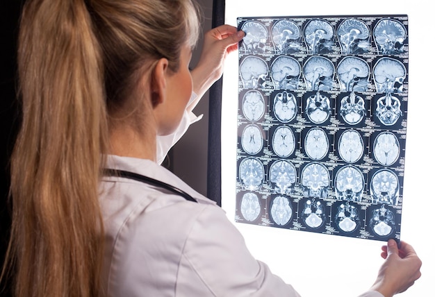 Back view of a doctor woman with blond hair holding mri in her hands