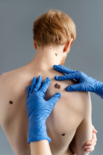 back view hands touching skin around mole