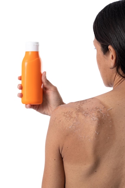 Back of woman with sunburn holding sunscreen bottle Isolated on white background with copy space Vertical format