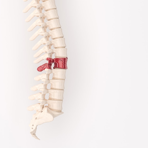 Backbone with red fragmented vertebrae. back problem concept. 3d render.