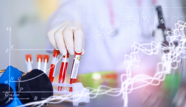 Background researcher in the laboratory is testing drugs for the treatment of viral pneumonia. Coronovirus blood test of infected patients. World pandemic.