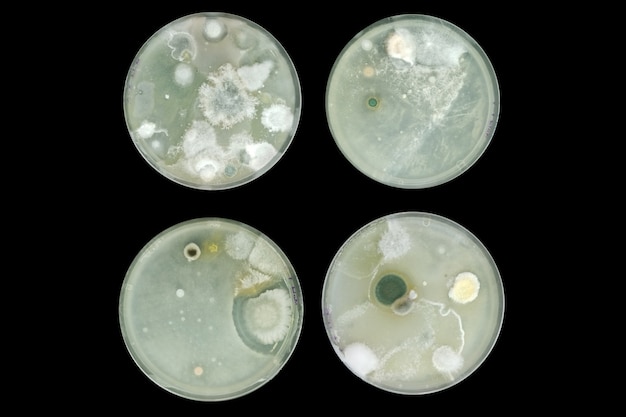 Photo bacteria on agar plate isolated from air