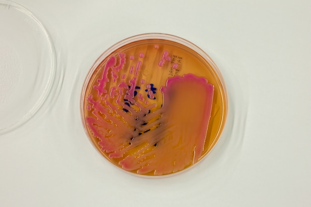 Bacteria in culture media in the laboratory