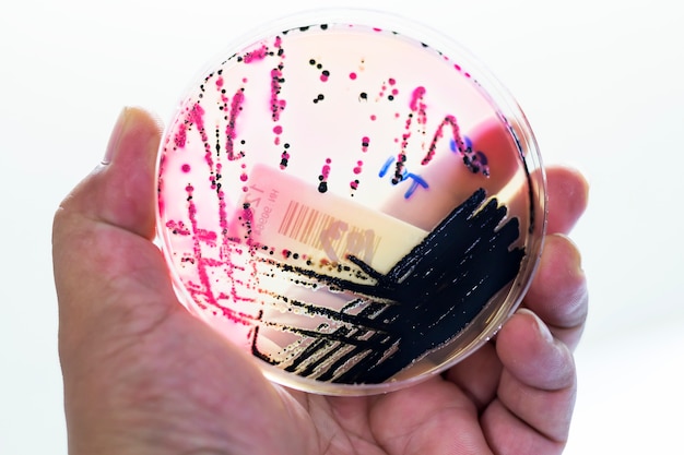 Bacteria in culture plates