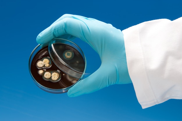 Bacterial colonies on agar plate