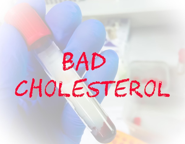 Bad Cholesterol term for  medical conceptual image.