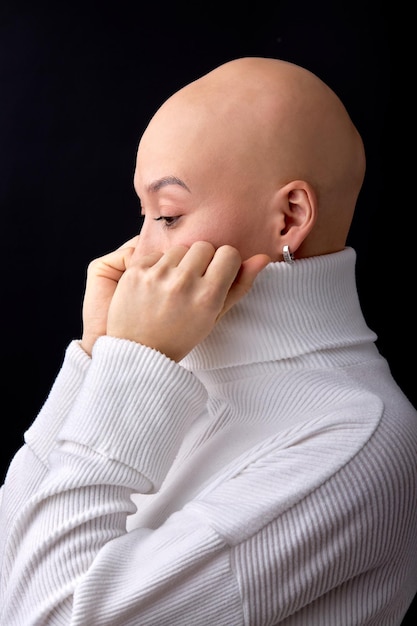 Bald woman posing for images supporting Cancer Awareness or alopecia problem campaigns worldwide. isolated black studio background. side view portrait of hairless lady wearing white shirt