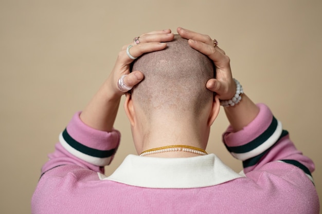Bald woman touching head with no hair