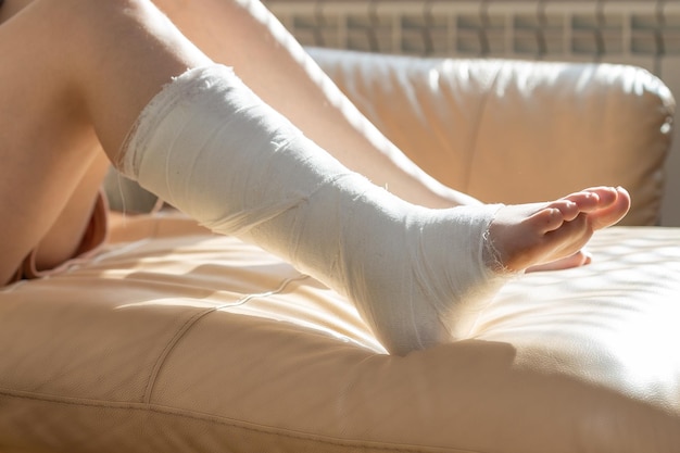 Bandaged leg cast and toes after a running injury accident.\
cropped shot of a girl. shin splints