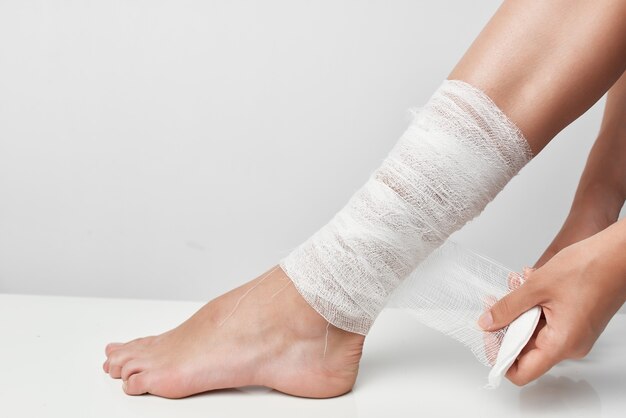 Bandaged leg injury health treatment lifestyle