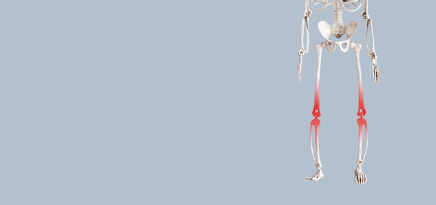 Banner with skeleton with red points at painful knees Arthritis infection gout leg injury consequences Health problems medical conditions concept Copy space